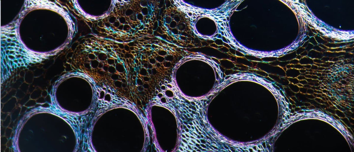 Does stress cause cell death?