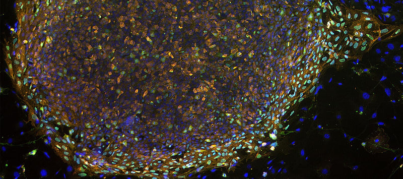 Thumbnail for Meet your stem cells